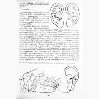 Мануальная, гомеопатическая и рефлексотерапия остеохондроза позвоночника. Самосюк И.З